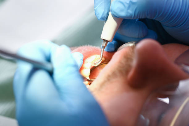 Best Emergency Care for Gum Disease in Sherwood, AR